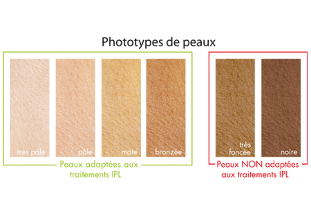 Nouvel IPL Pro Rio : phototypes de peau